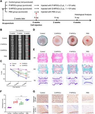 Quiescence preconditioned nucleus pulposus stem cells alleviate intervertebral disc degeneration by enhancing cell survival via adaptive metabolism pattern in rats